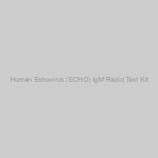 Image of Human Echovirus (ECHO) IgM Rapid Test Kit
